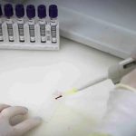 Paciente em SP com suspeita de ebola testa positivo para meningite