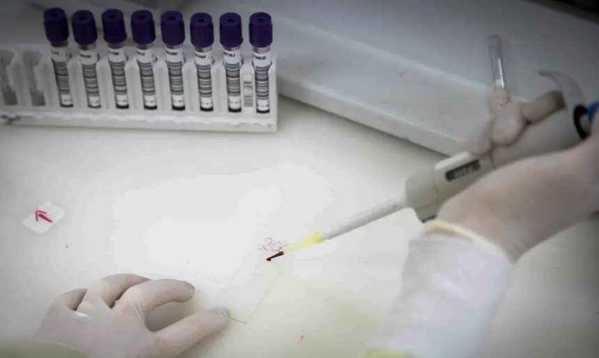 Paciente em SP com suspeita de ebola testa positivo para meningite