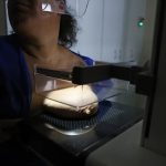 ANS defende que plano cubra mamografia digital sem restrição de idade
