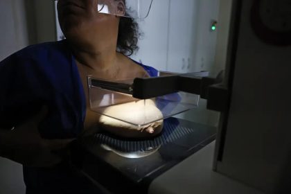 ANS defende que plano cubra mamografia digital sem restrição de idade
