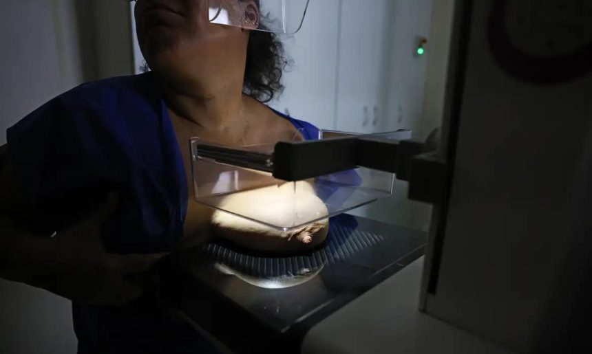 ANS defende que plano cubra mamografia digital sem restrição de idade