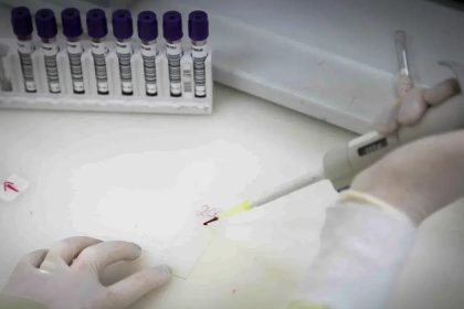 Exames descartam ebola em imigrante da República Democrática do Congo