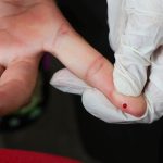 Brasil atinge meta de redução da transmissão vertical de hepatite B