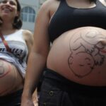 Fatores sociais e estruturais empurram mulheres para cesarianas