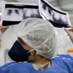 Diagnóstico tardio dá poucas chances de cura para o câncer de pulmão