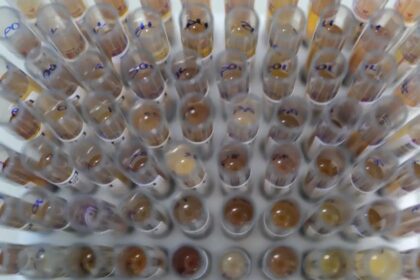 Uso de medicamento oferecido no SUS reduz casos de malária no Brasil