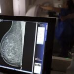 Plano de saúde terá que cobrir mamografia digital para todas as idades