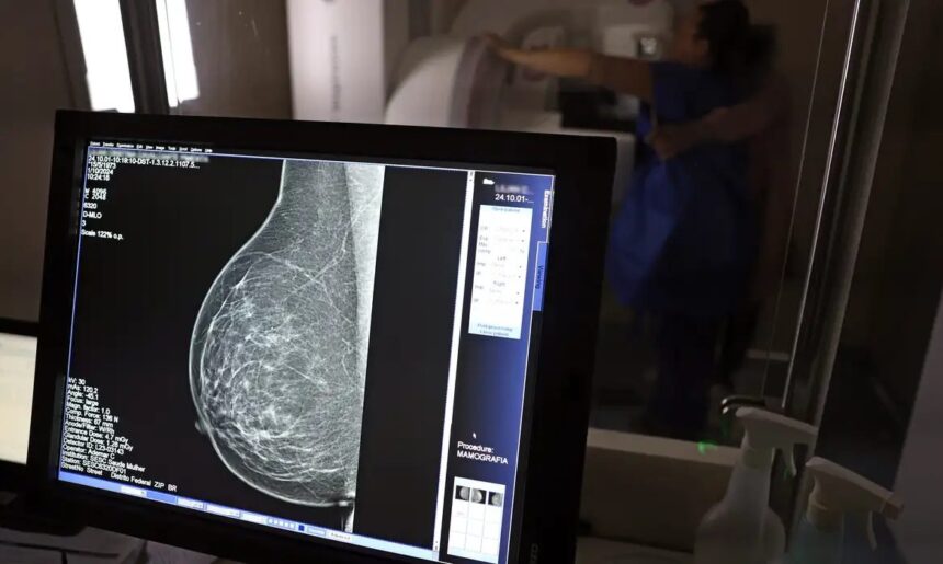 Plano de saúde terá que cobrir mamografia digital para todas as idades