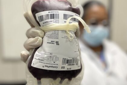 Saúde aprova protocolo para tratar crianças com hemofilia A